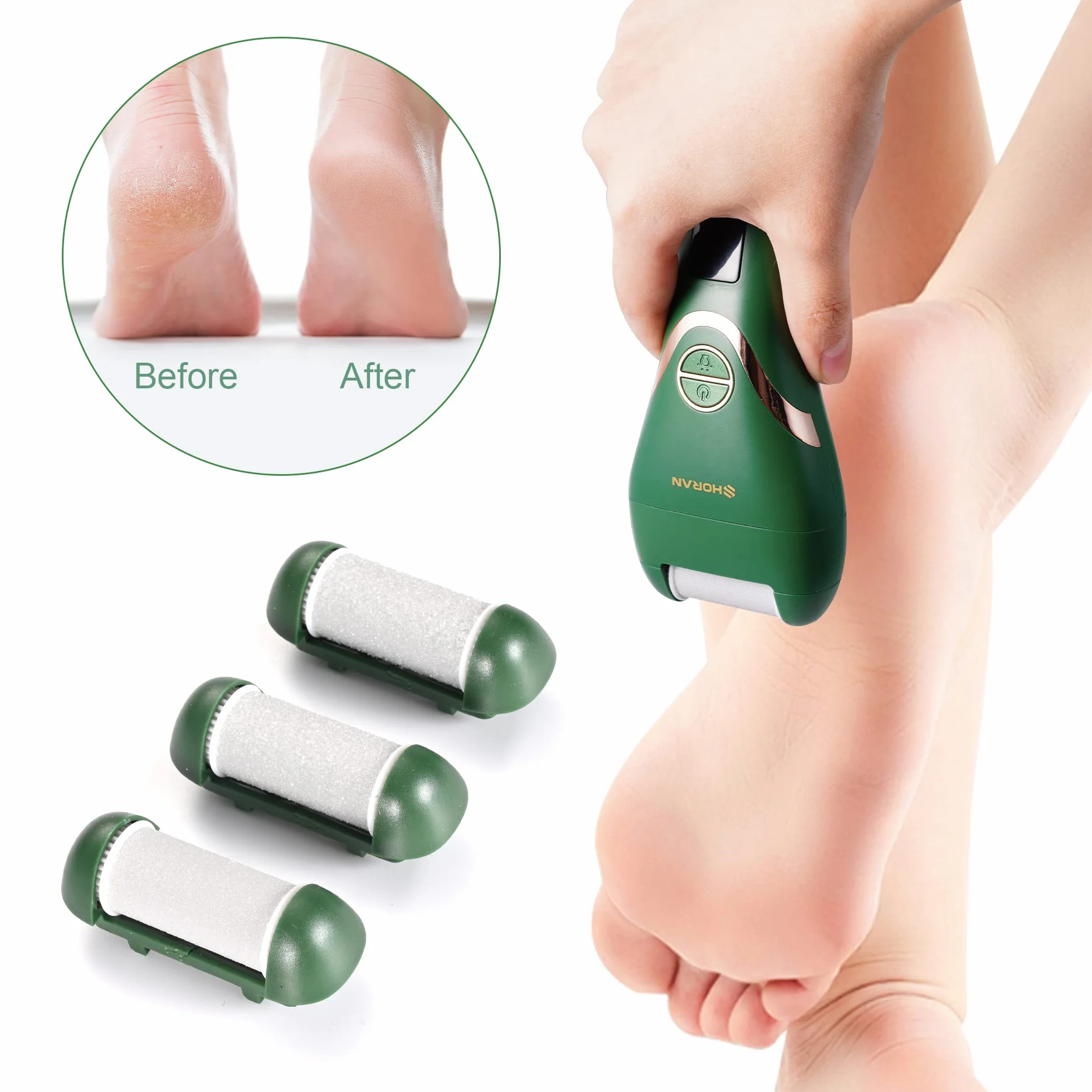 Testine di Ricambio per SHORAN SR01 Pedicure Elettrico