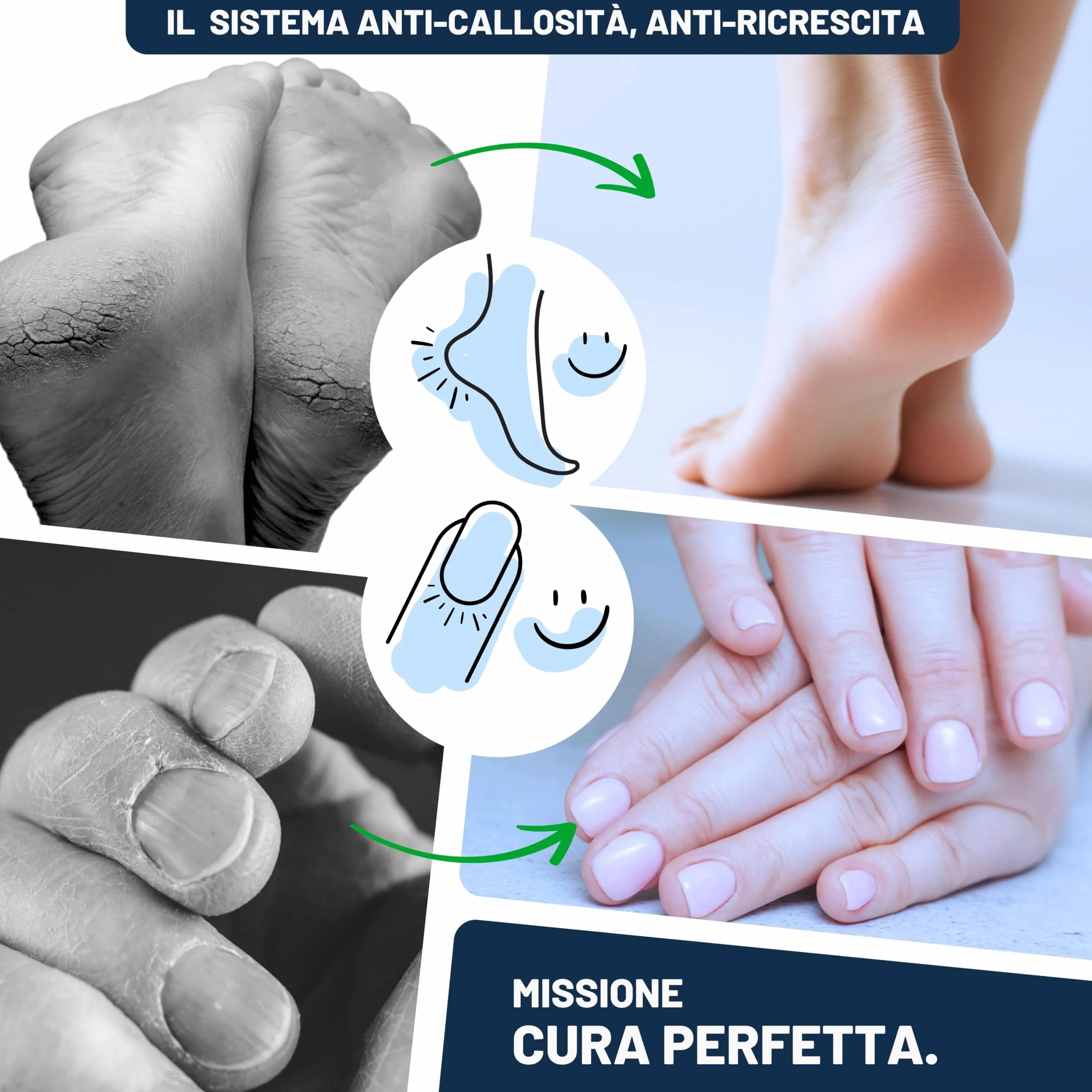 Mr. Fuss N. 1 Plus Pack Steel Piccolo 200 ml confezione risparmio rimozione cuticole calli acciaio inossidabile