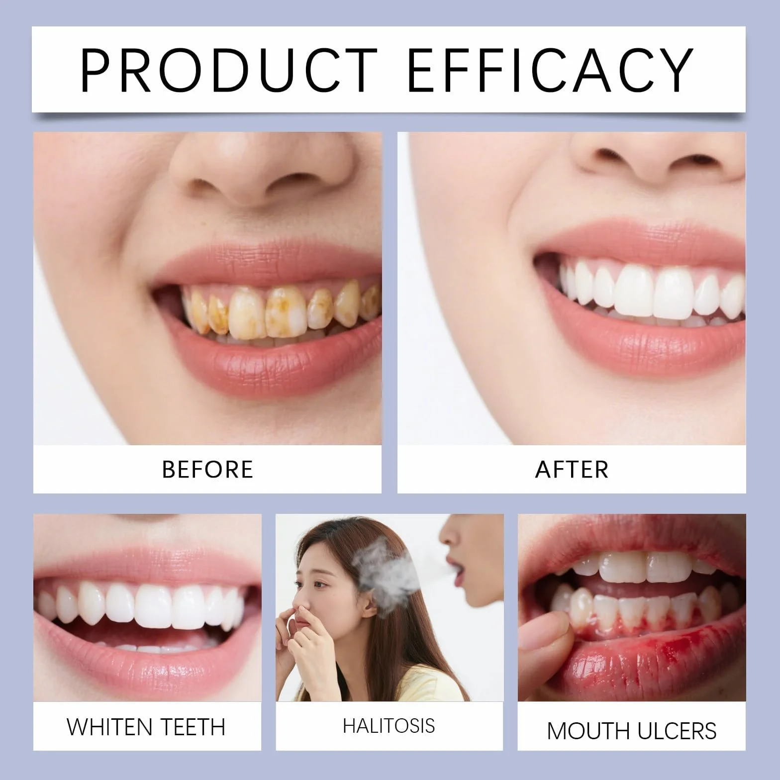 Siero riparatore dentale alla nanoidrossiapatite per igiene orale, cura denti e gengive, rimozione tartaro, alito fresco