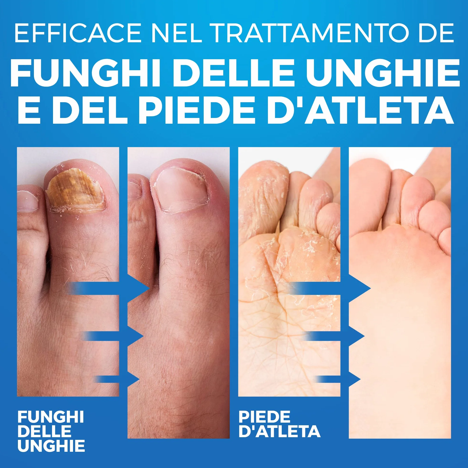 Imperial Feet Spray Deodorante per Scarpe Extra Forte 150ml - Elimina Odori dei Piedi - Protezione 24h Antifungino